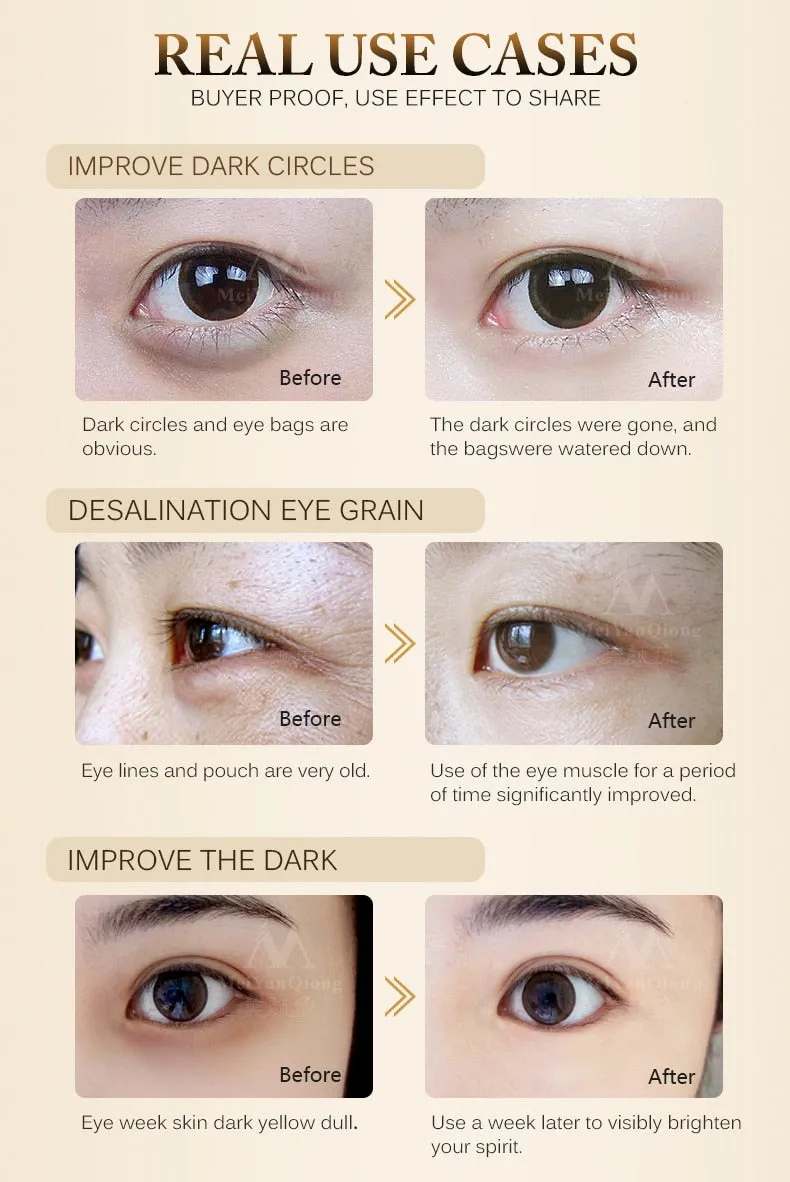 Anti-Wrinkle Eye Cream Remove Dark Circles Remove Dark Circles