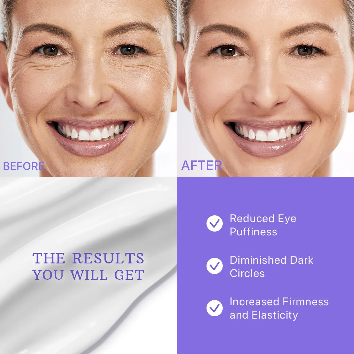 Eye Cream for Dark Circles & Puffiness - Day & Night Collagen Hydrating Caffeine Eye Cream for Wrinkles - Anti Aging Effect
